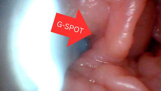 First time: An endoscope reveals the G-spot up close - without mountingl