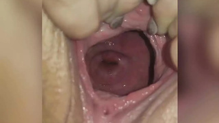 Wide open pussy and cervix show